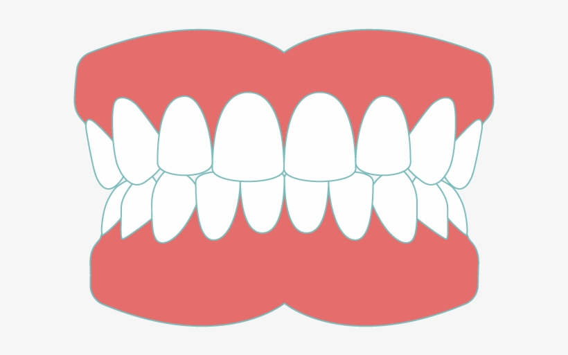 Dentures Sudbury - Greater Sudbury, transparent png