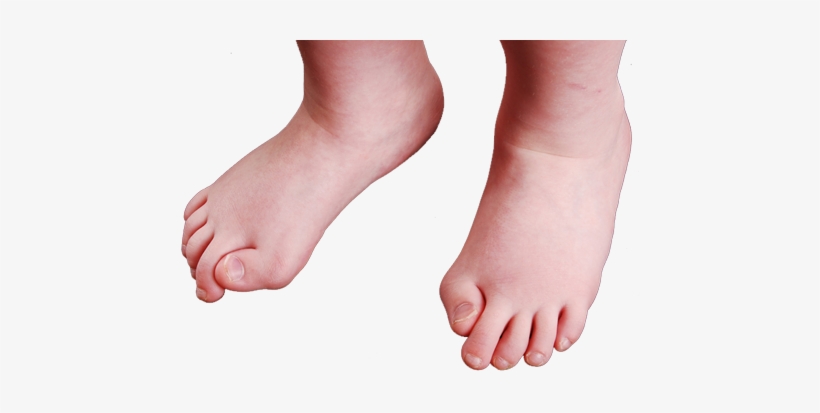 Toes - 性 骨 化 性 線維, transparent png