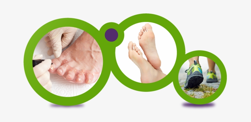 Foot Care - Foot Ulcer Causes, transparent png