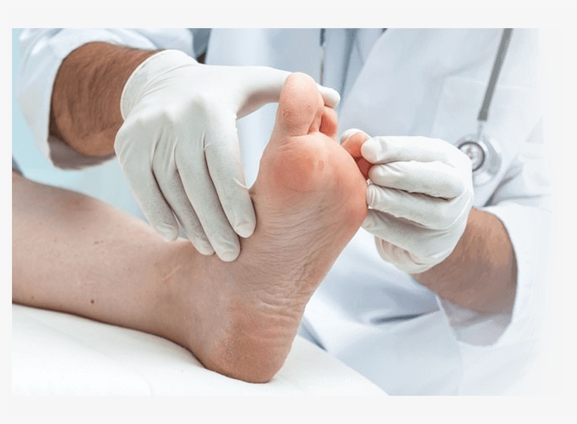 Podiatry Services - صور مسمار القدم, transparent png