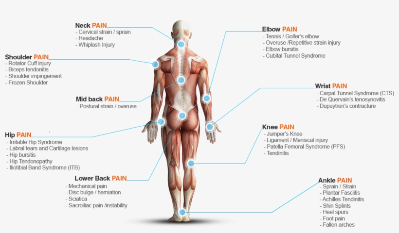 Conditions We Treat - Diagram, transparent png
