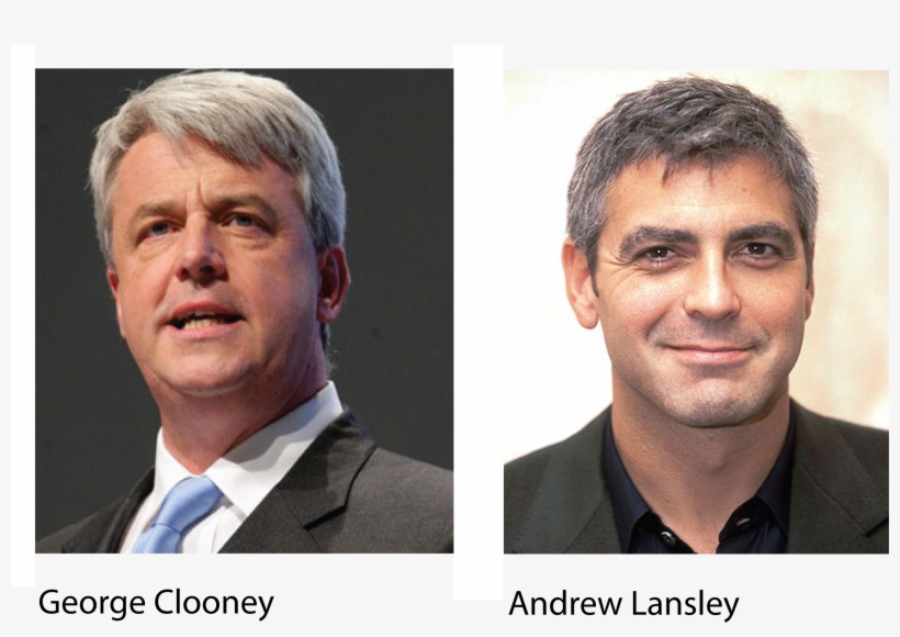 Health Reform Bill Movie To Star George Clooney As - Hair Loss Men Front, transparent png