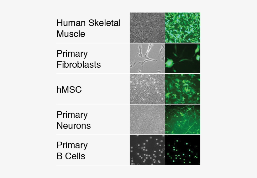 High-performance Transfection Of A Variety Of Human - Fibroblast Primary Cell, transparent png