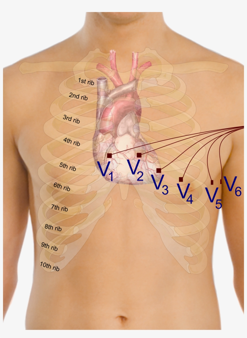 Precordial Leads In Ecg - Ecg For Beginners [book], transparent png