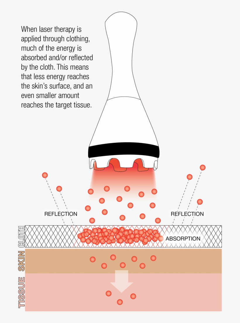 Treating Off Contact Clothing Thin - Diagram, transparent png