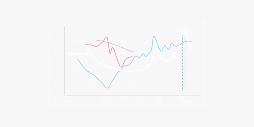 1st 96 Um Dental Laser - Dental Laser, transparent png