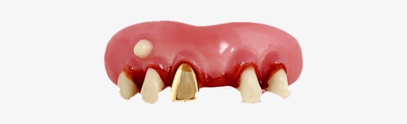 Finally We Have Rich Zombie Teeth - Gold Miner Billy Bob Teeth, transparent png