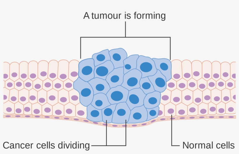 Open - Cancer Cells Diagram, transparent png