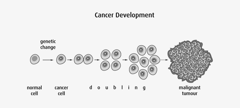 Other Forms Of Cancer Treatment, Such As Chemotherapy - Tumeur Bénigne Et Maligne, transparent png
