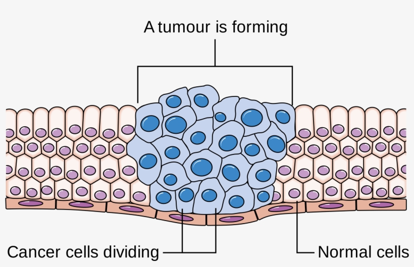 Drugs Used To Target Tumour Cells During Chemotherapy, transparent png