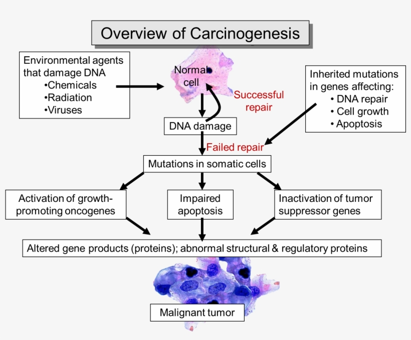 Canceroverview - Cancer, transparent png