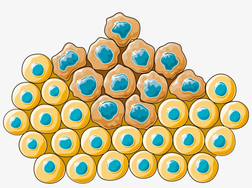 Carcinoma - Cancer Cell Clipart, transparent png