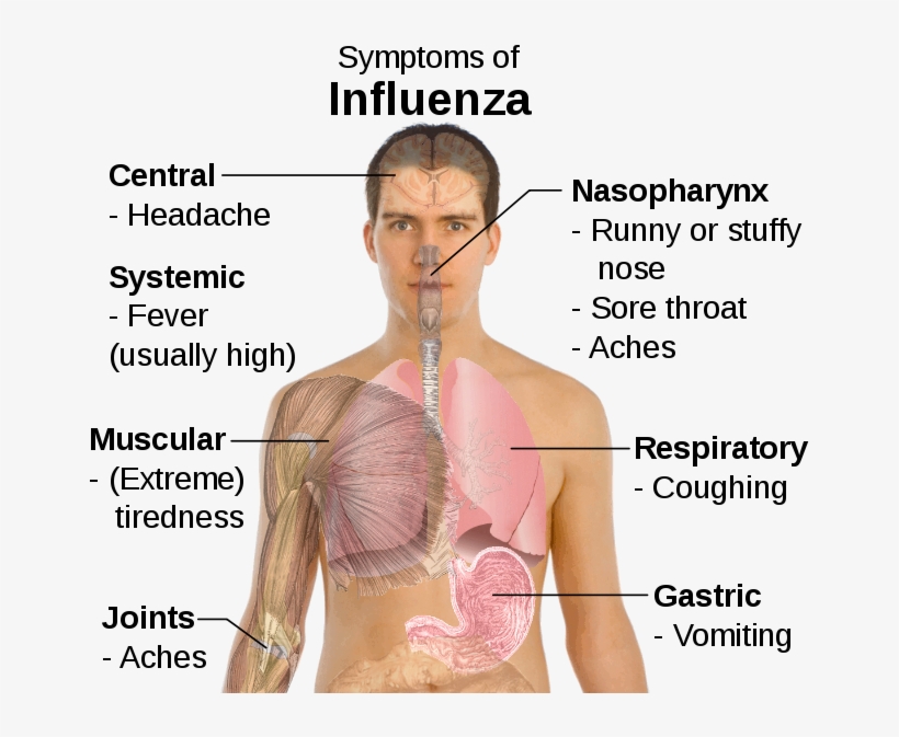 Flu Symptoms - Symptoms Of Influenza, transparent png