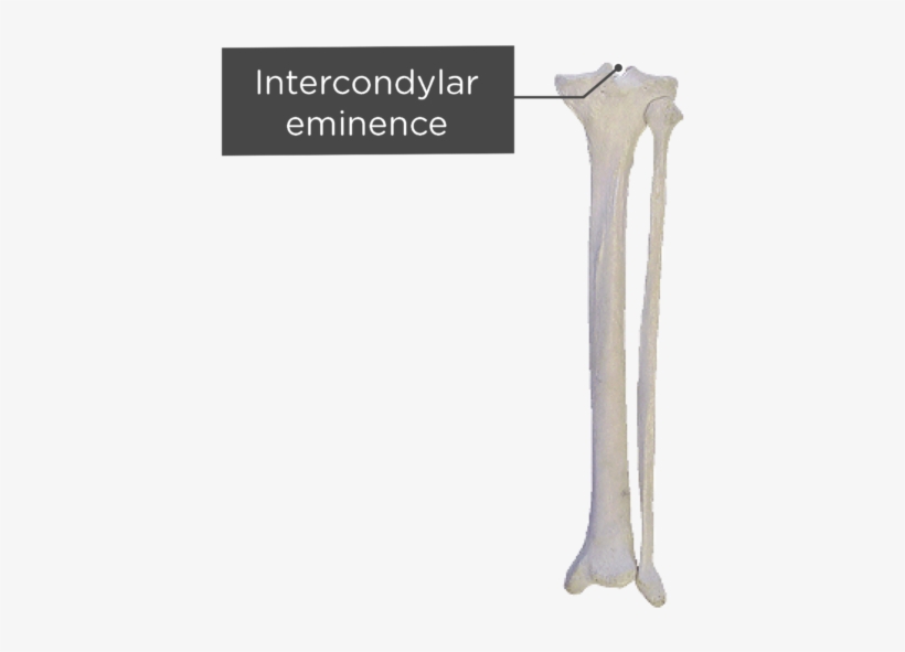 Tibia And Fibula - Fibula - 745x550 PNG Download - PNGkit