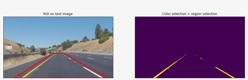 Region Of Interest On Test Image And Selected Region - Shoulder, transparent png