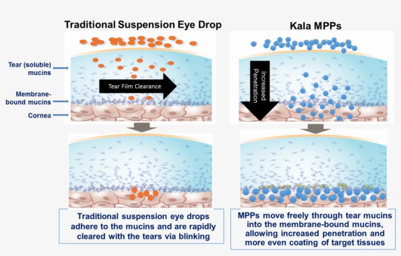 This Graphic Is Included For Illustrative Purposes - Kala Pharmaceuticals, transparent png