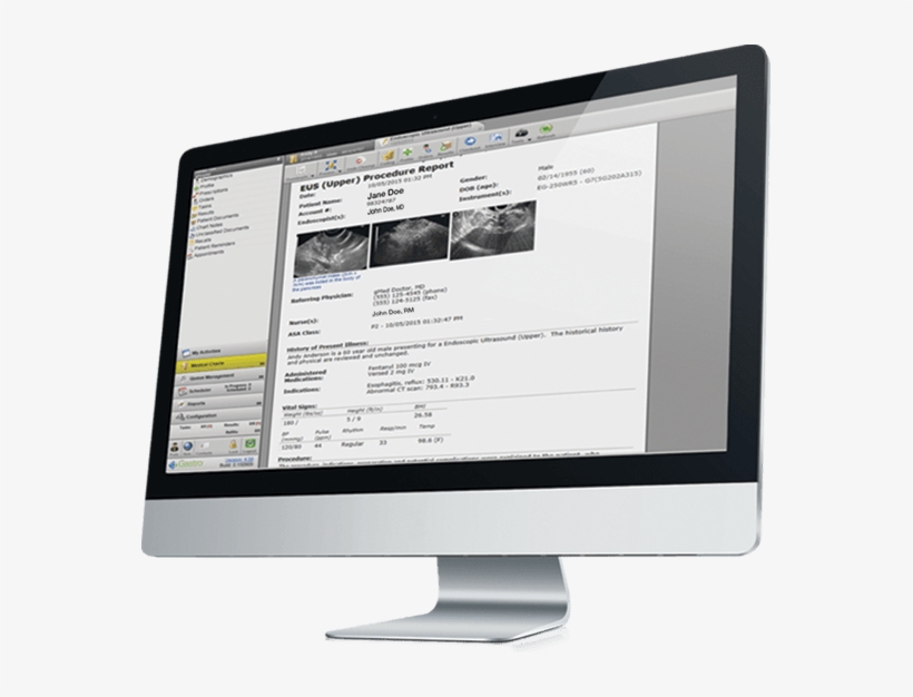 Endoscopy Report Writer On Imac - Computer Monitor, transparent png