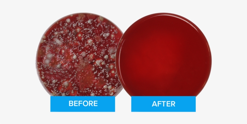 This Image Of The Petri Dishes Shows The Results Of - Phonesoap 3 - Aqua, transparent png