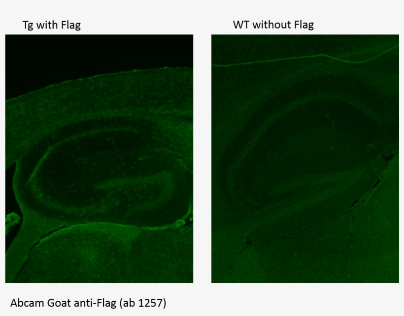 Abreview Image - Colorfulness, transparent png