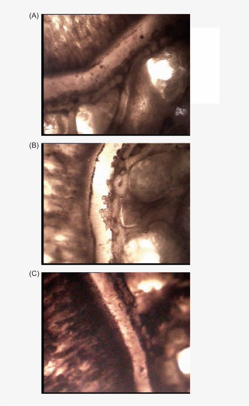 Effect Of Alcohol And Aqueous Extracts Of Young Prop - Medical Imaging, transparent png