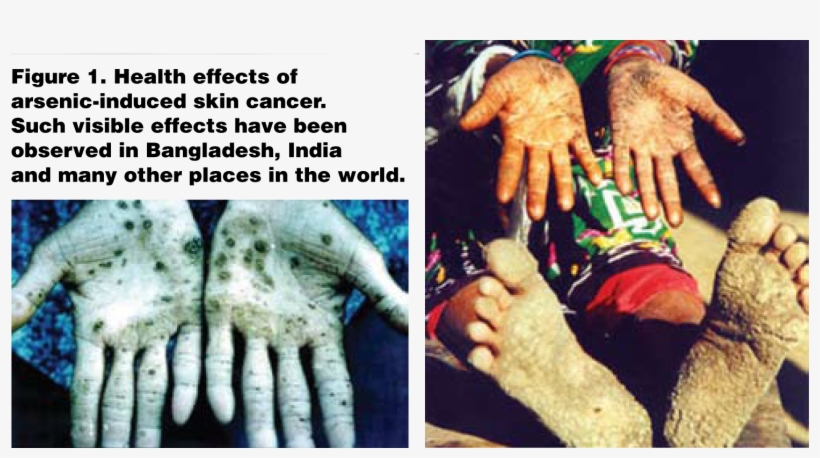 And Lymphatic System As Well As Development Of Lung - Arsenic Used For Today, transparent png