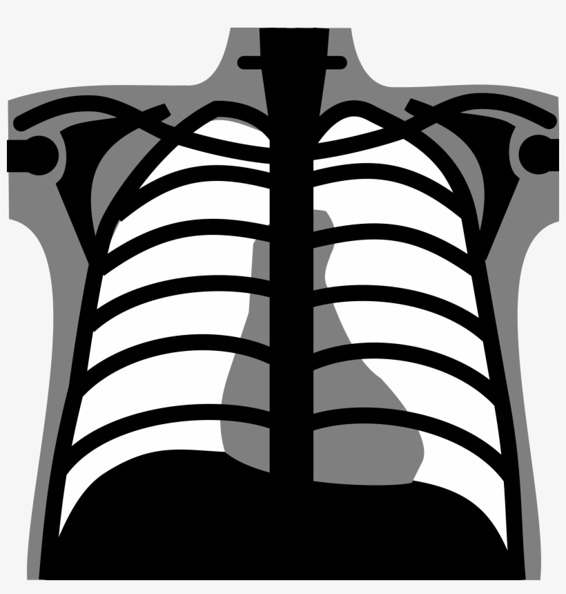 Open - Chest X Ray Icon Png, transparent png