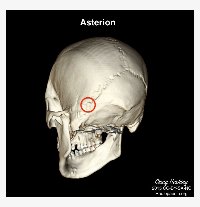 Version Of Skull Landmarks Images - Asterion On The Skull, transparent png