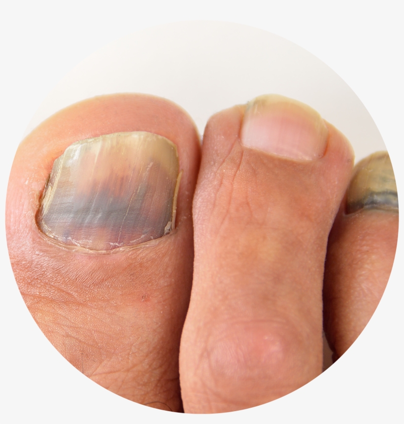 Subungual Nail Circle, transparent png