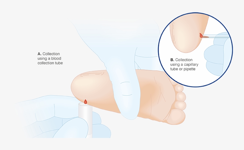 Expert Tip - Capillary, transparent png