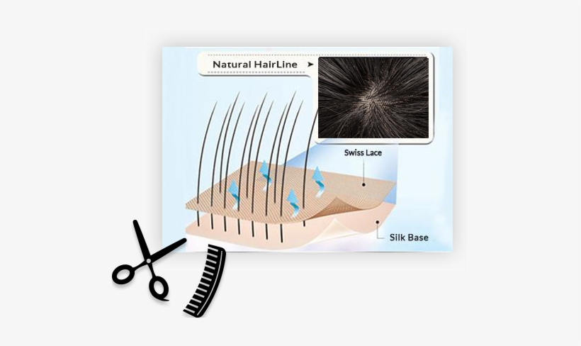 Hair Replacement For Men-hair Loss Solutions Newhairline - Hair Transplantation, transparent png