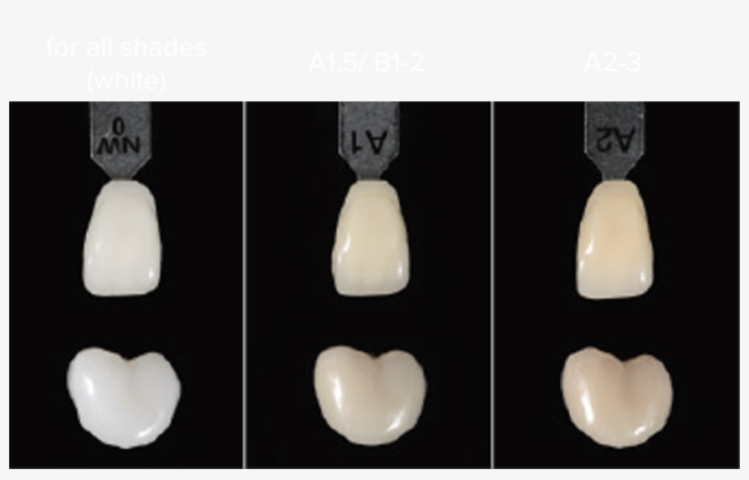 Cover Range Of Noritake Shade Guide Ceramic 1056x626 PNG Download