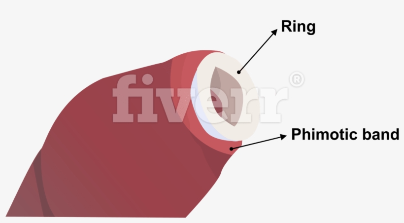 Digitally Draw Anatomy Diagrams And Medical Illustrations - Fiverr, transparent png