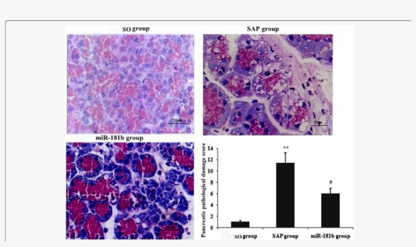 Effects Of Overexpression Of Mir-181b On Pancreas Damage - Common Fig, transparent png