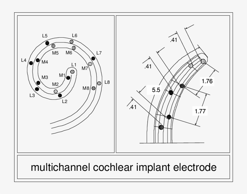Schematic Illustration Of An Intracochlear Multichannel - Diagram, transparent png