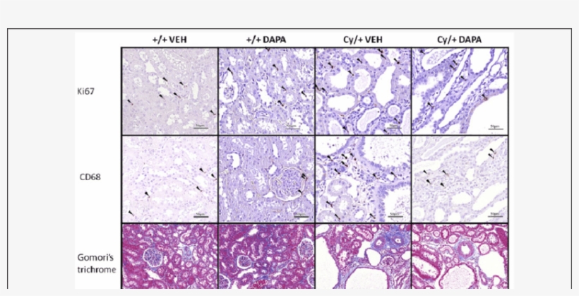 Histological Analysis For Ki67, Cd68 And Interstitial - Cd68, transparent png