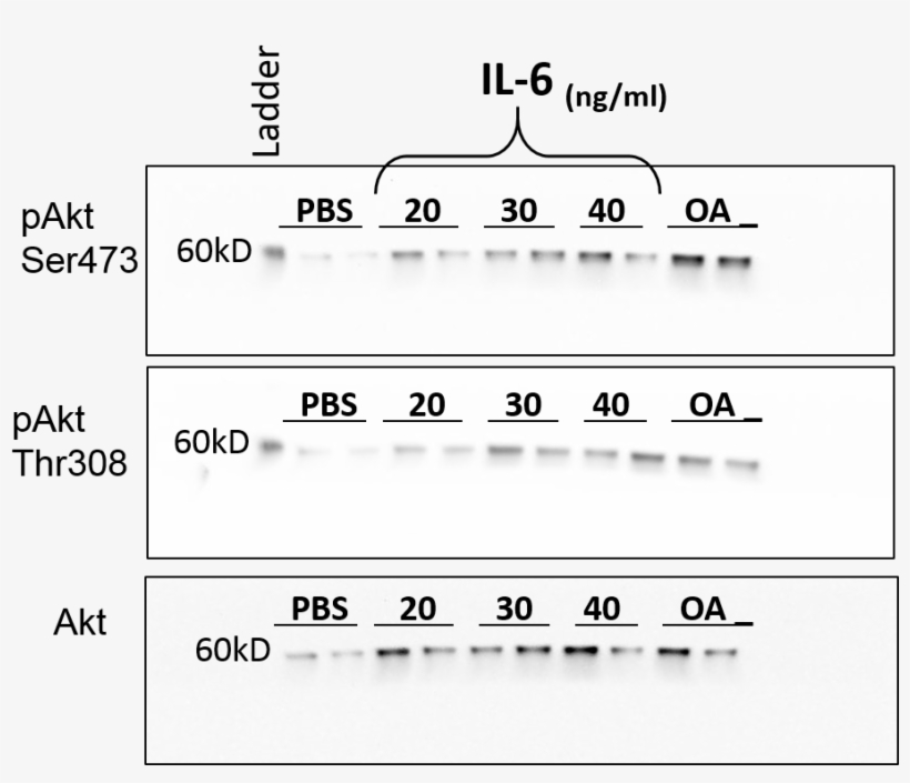 In Vitro Bioactivity In Cell Culture Recombinant Human - In Vitro, transparent png