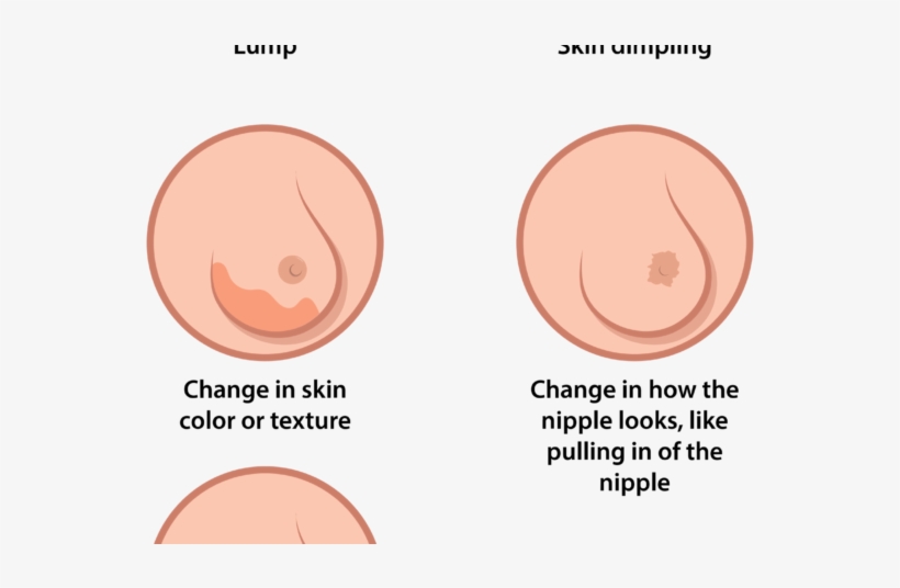 Breast Cancer Is A Woman's Greatest Fear, But Also - Play Button Icon, transparent png