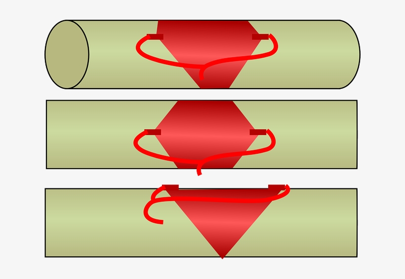 "diamond" Charge With C4 On Steel Bars, transparent png