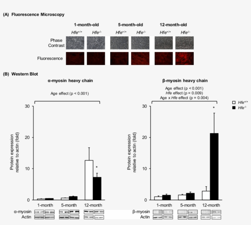 Effect Of Age On The Expression Of Cardiac Myosin Heavy - Diagram, transparent png