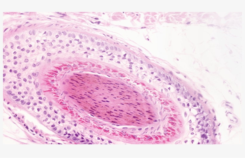 Hair Follicle Cross Section - Close-up, transparent png