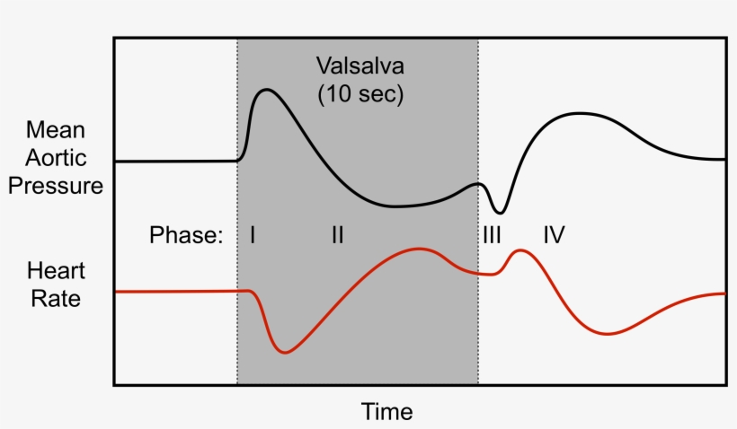 Hemodynamics Of A Valsalva Maneuver - Valsalva Phases, transparent png