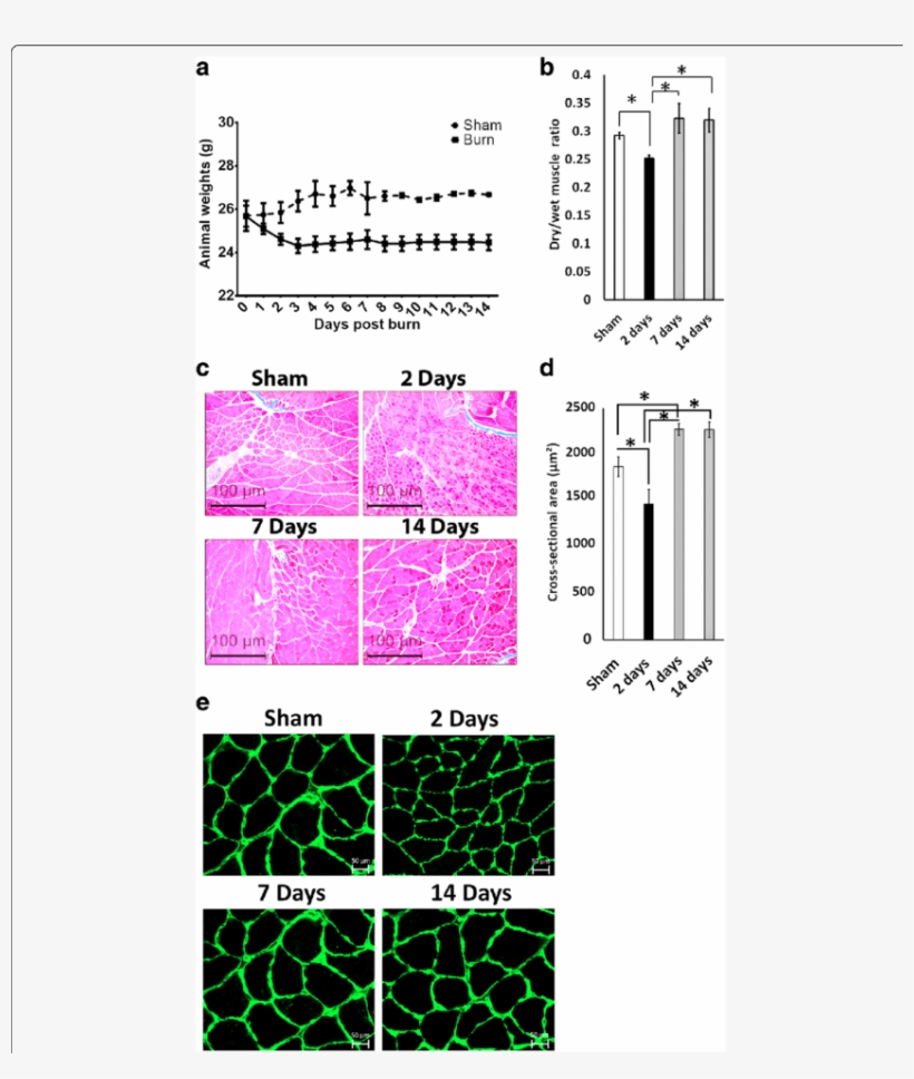 Thermal Injury Leads To A Transient Muscle Atrophy - Muscle, transparent png