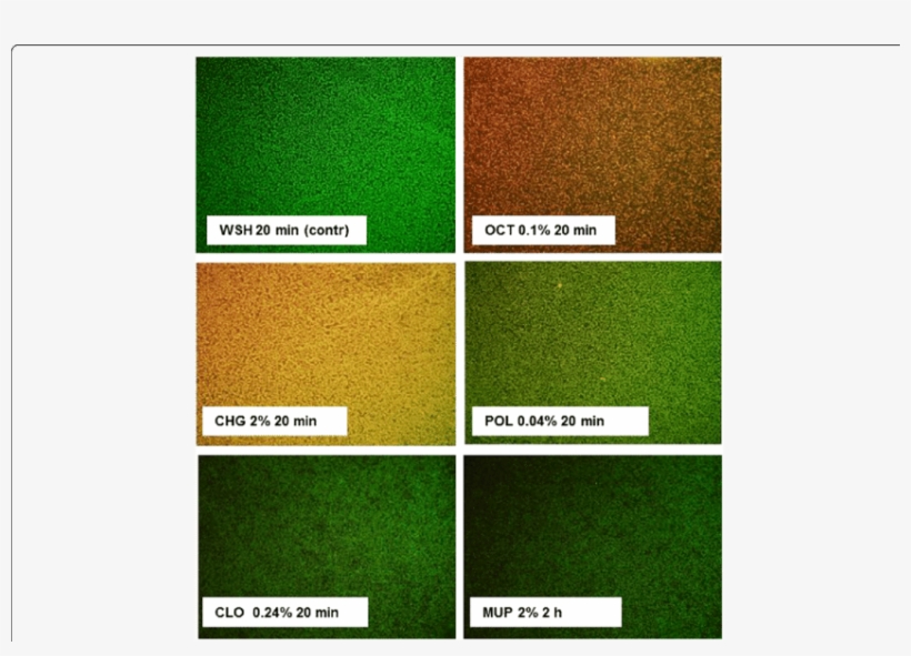 Killing And Permeation Of Mrsa Biofilms By Antimicrobials - Common Fig, transparent png
