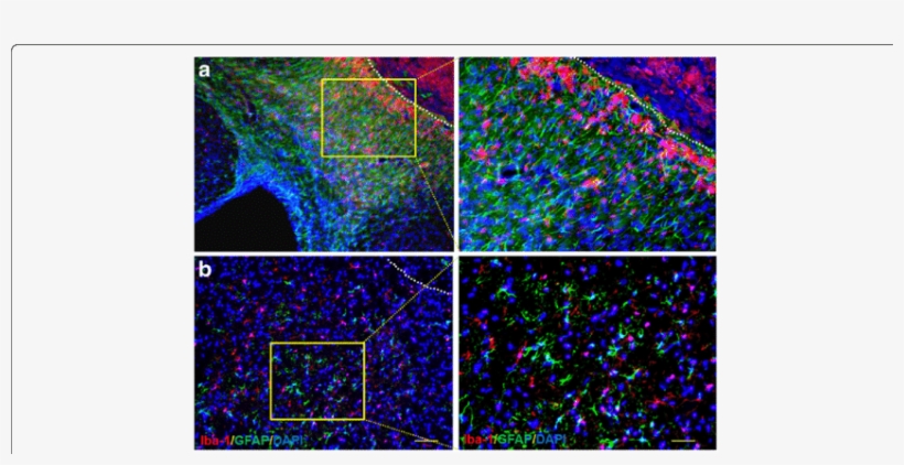 Stroke Lesion Diminished At Day 14 After Brain Ischemia - Common Fig, transparent png