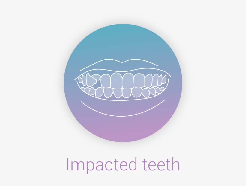 Ebrace Impacted Teeth - Circle, transparent png