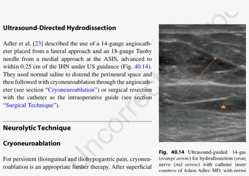 13 Ultrasound Image Of The Ilioinguinal And Iliohypogastric - Ilioinguinal Nerve Ultrasound Nerves, transparent png