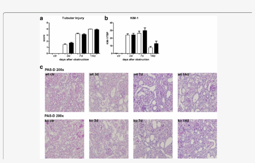 Renal Injury In Wt And Nod1/2 Dko (black Bars) Mice - Common Fig, transparent png