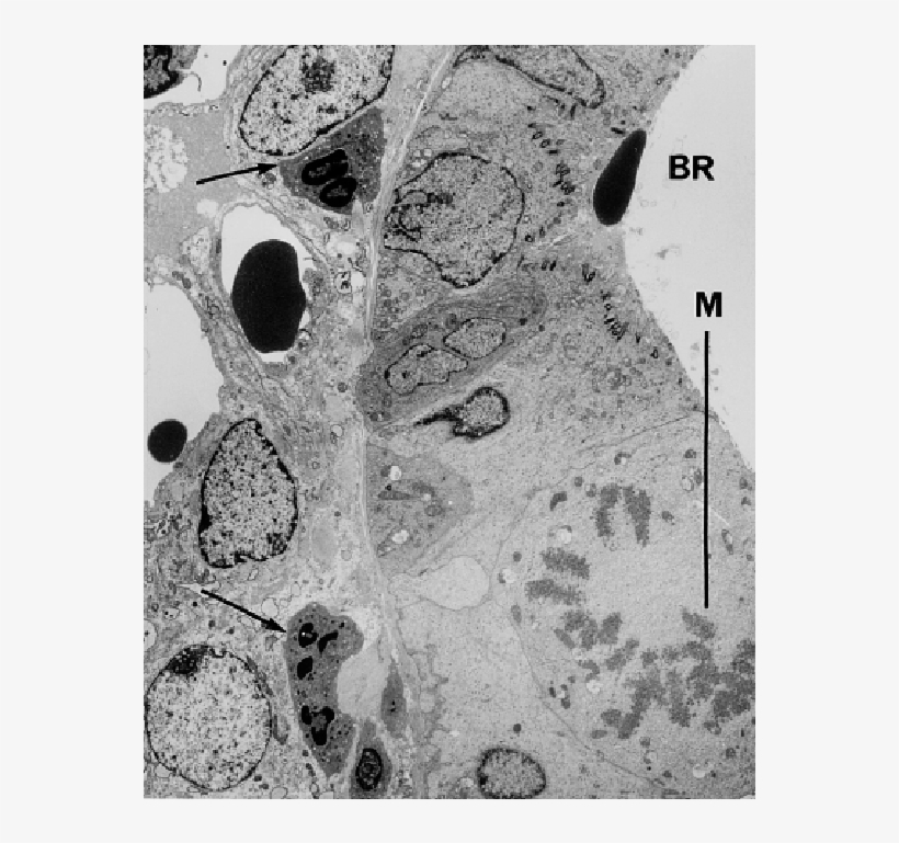 Em Of An Area Near The End Of A Bronchiole After Coexposure - Epithelium, transparent png