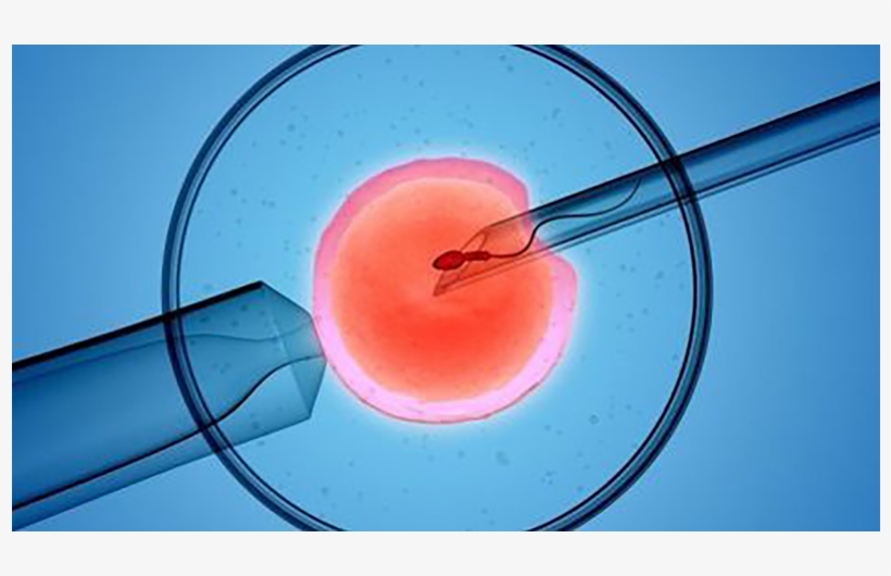Ivf Possible Despite A Semen Report Showing Dead Sperm - Ivf, transparent png