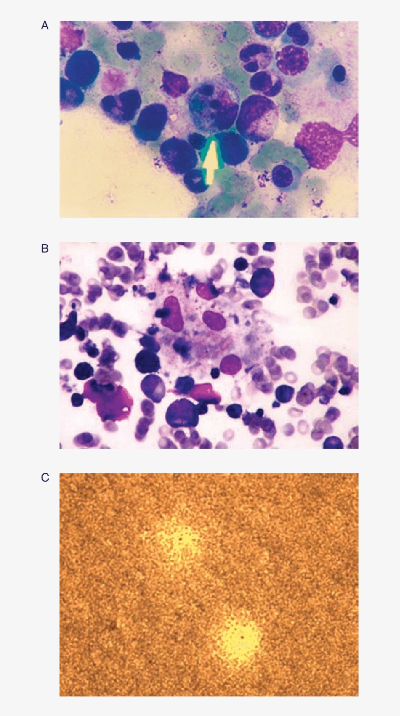 Light Microscope Image Showing Macrophages Phagocytizing - Microscope, transparent png